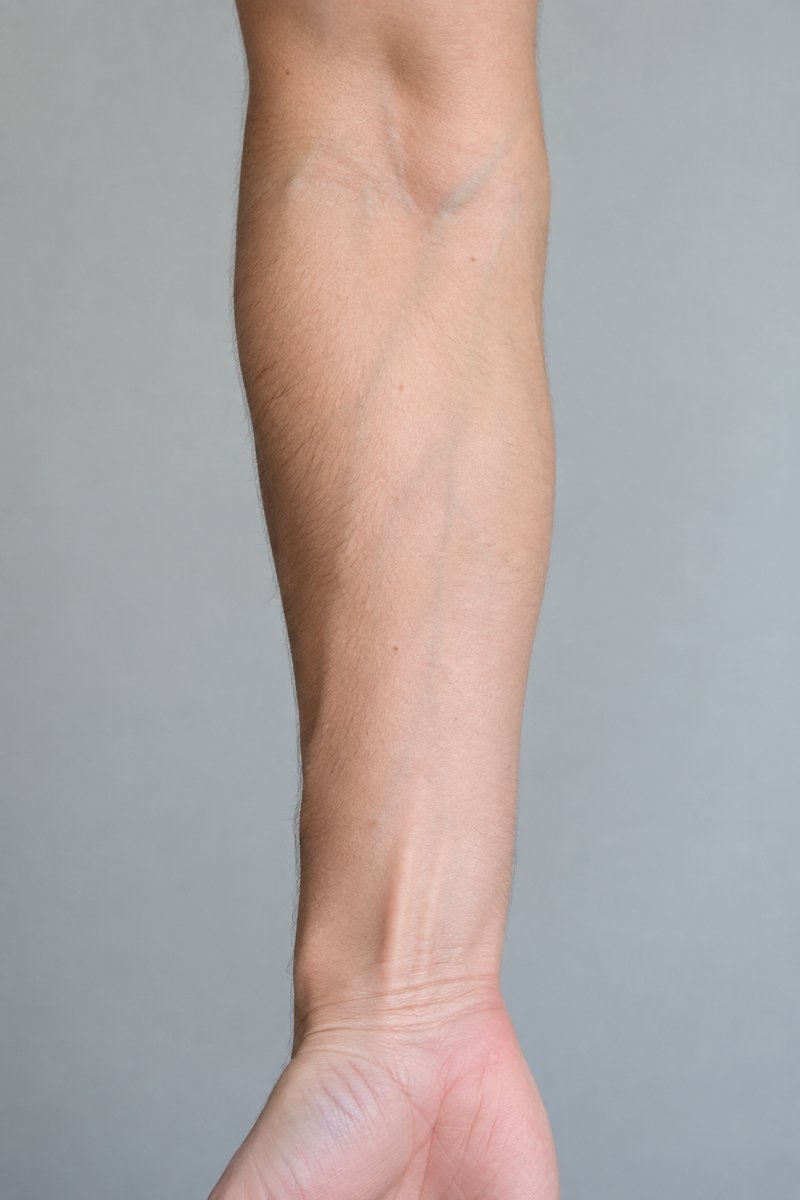 A bare forearm
